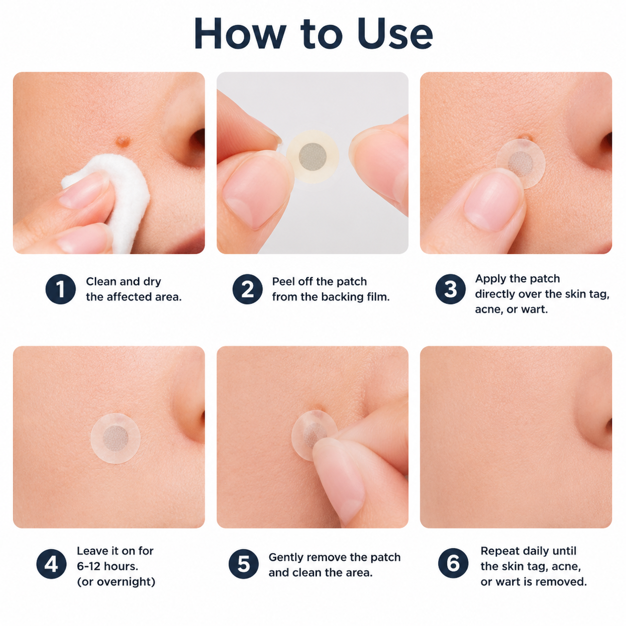 VUSSUV® Microneedle Clear Patches ✨Targets Skin Tags, Acne, Wrinkles & Blemishes
