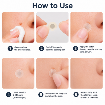 VUSSUV® Microneedle Clear Patches ✨Targets Skin Tags, Acne, Wrinkles & Blemishes